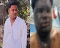 என்னது LOVE-ஆ..? கொதிக்க கொதிக்க எண்ணெய்யை ஊற்றிய காதலியின் தாய்..! வெந்துப்போன இளைஞரின் முகம்..!! 