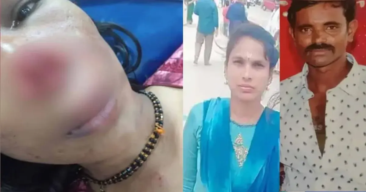 Karnataka - husband bites wife nose 