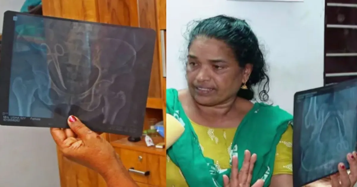 தீராத வயிற்று வலியால் அவதிப்பட்ட உஷா... அறுவை சிகிச்சை செய்த மருத்துவர்களுக்கு காத்திருந்த அதிர்ச்சி...!